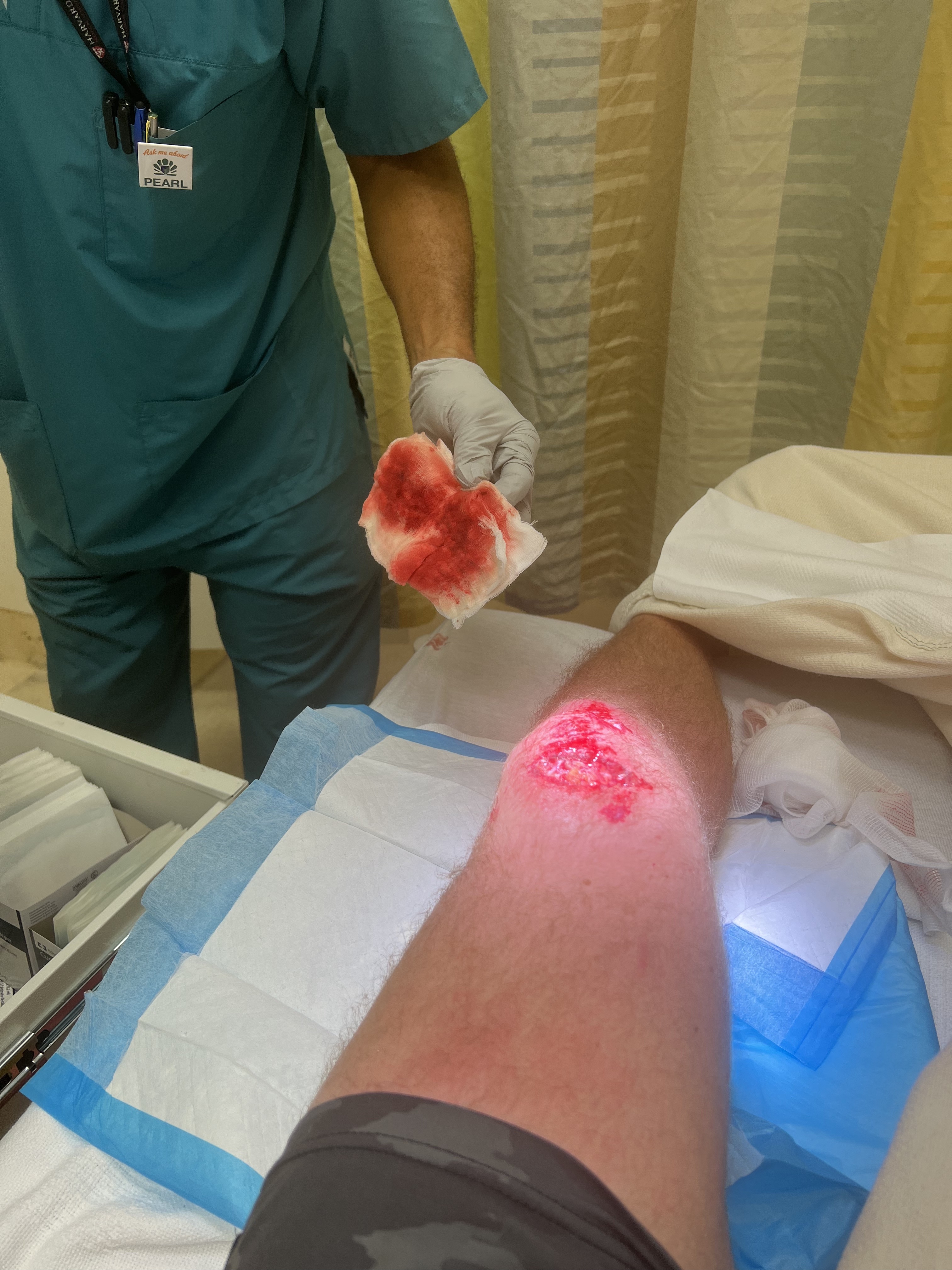 Grayson Murray's knee post scooter accident in Bermuda